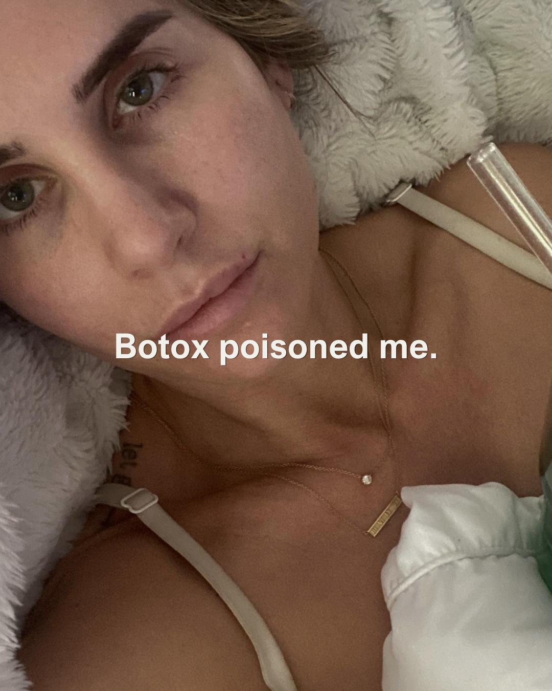 “I Got Botox Poisoning” My Interview with The Hive