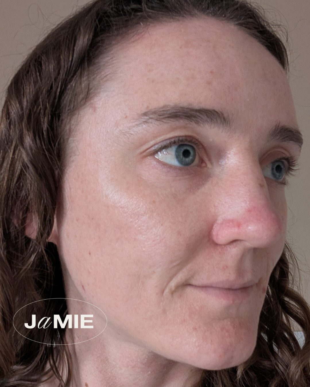 Client's face showing improved skin after consultation