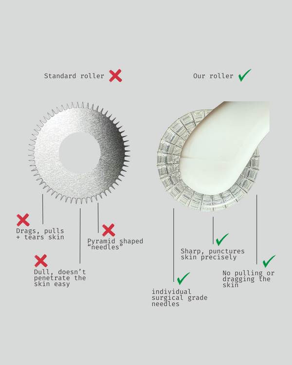 JAMIE ANNE Roller with real individual needles versus standard disc-type dermaroller